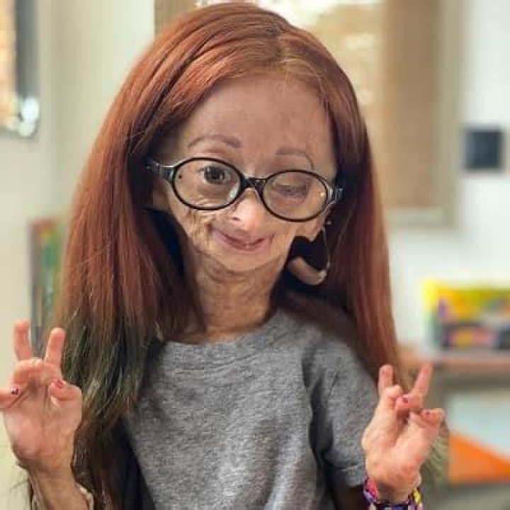 Adalia Rose career