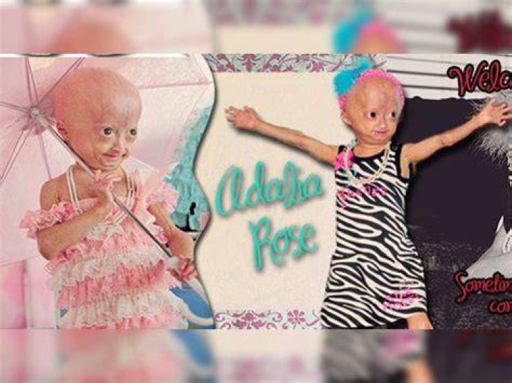 Adalia Rose height