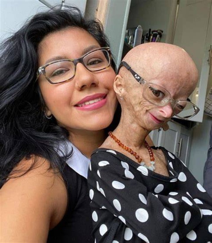 Adalia Rose with her mother Natalia Amozurrutia