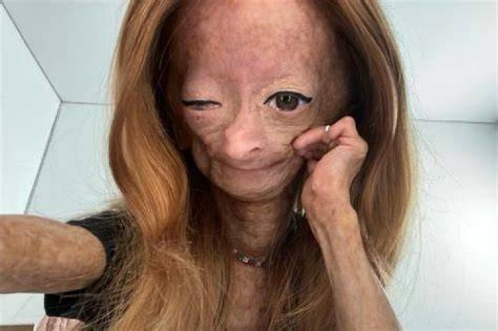 Adalia Rose's childhood photo