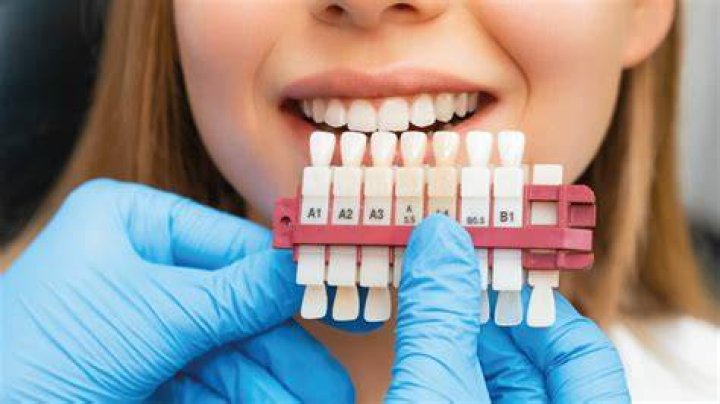 Di che colore sono i denti di Beavers?