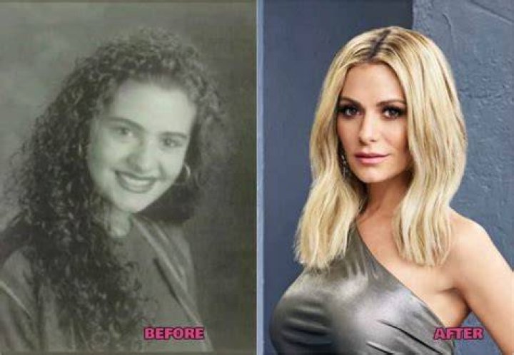 Did ‘RHOBH’ Star Dorit Kemsley Get Plastic Surgery? Everything She’s Said About Getting Work Done