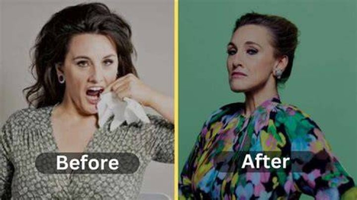 Grace Dent Weight Loss Journey: Before And After Photos, Diet Plan And Workout