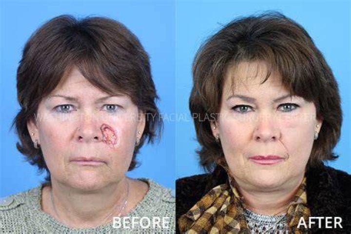 Marilyn Grabowski Accident And Face Surgery: Before And After Photos
