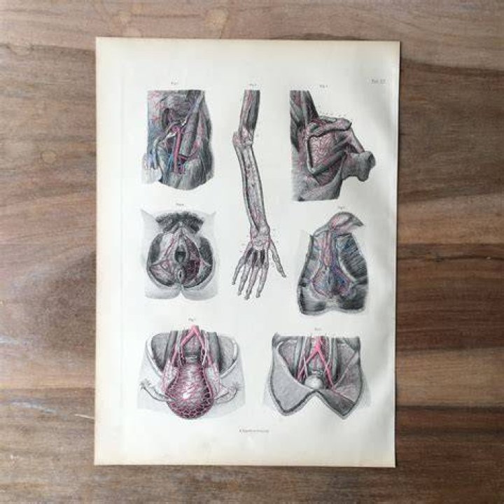 Medical Engraving From The Court Midwife