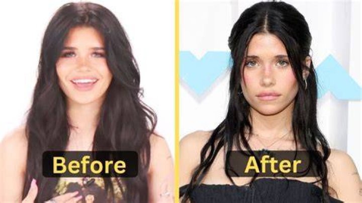 Nessa Barrett Weight Loss Update: Here Are Before And After Pictures