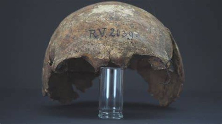 Oldest Plague Victim Teeth