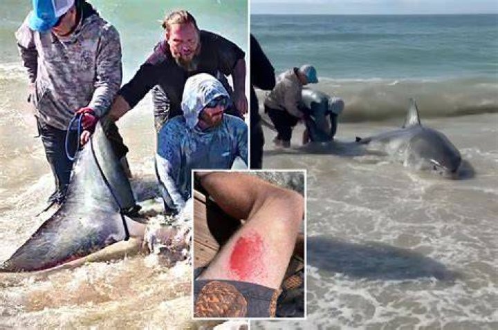 Wounds Of Oldest Shark Attack Victim