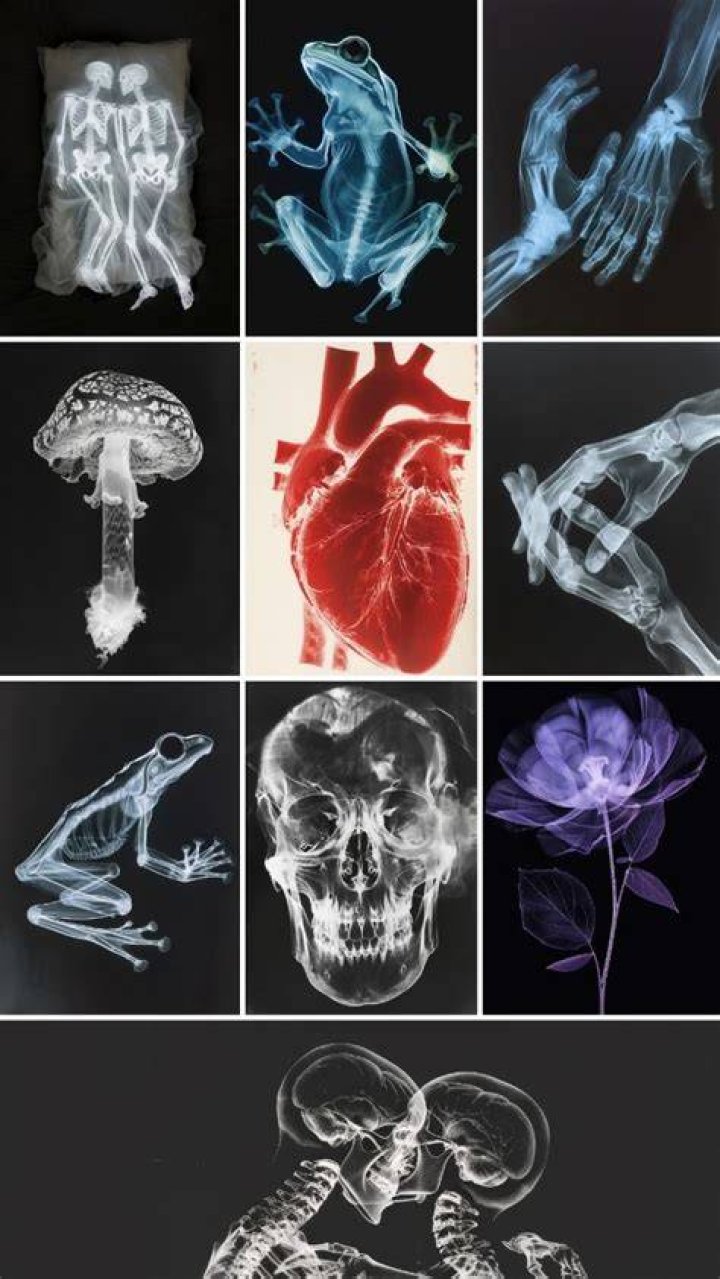 X Ray Art