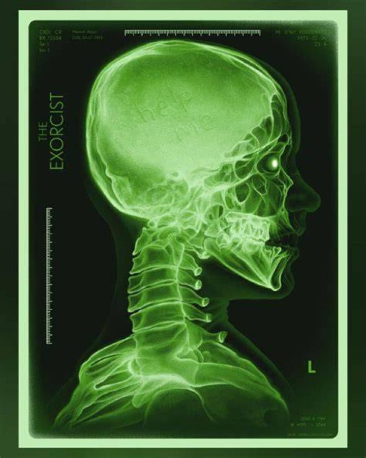 X Ray Green