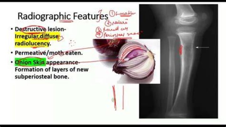X Ray Onion Tubers