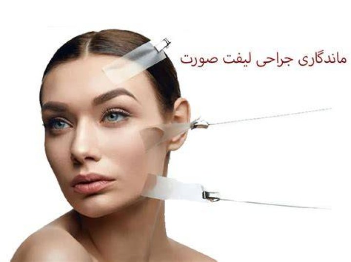 آیا آنا گان لیفت صورت داشت؟
